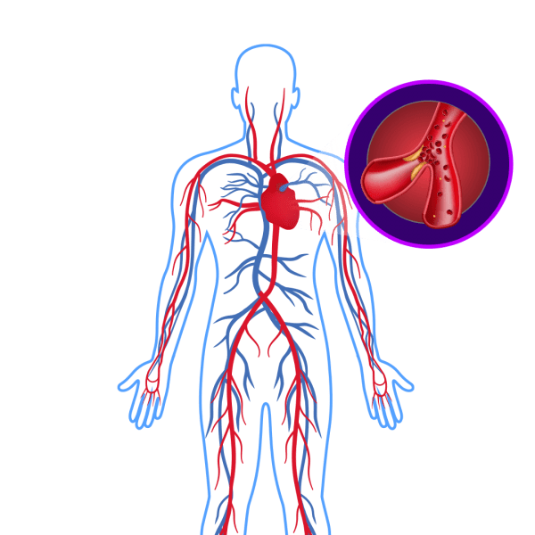 Cholesterol & Triglycerides Control