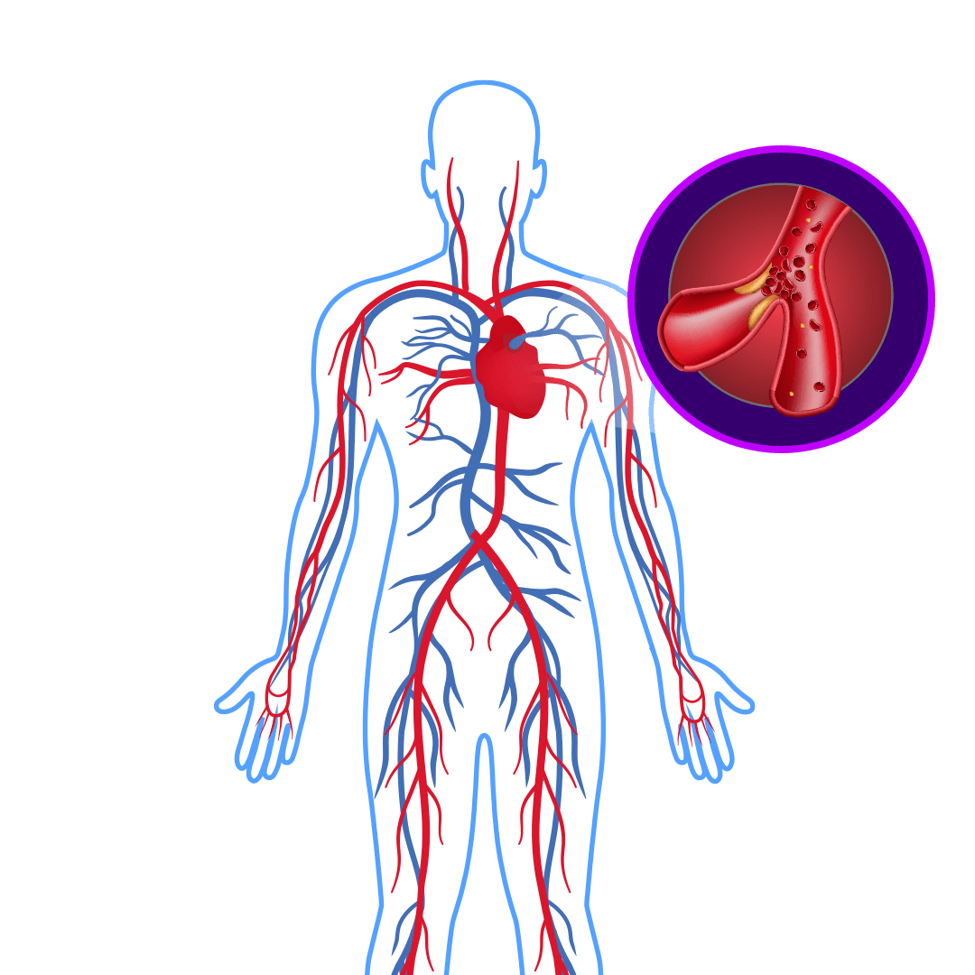 Cholesterol & Triglycerides Control