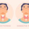 Thyroid Explained: What You Need to Know