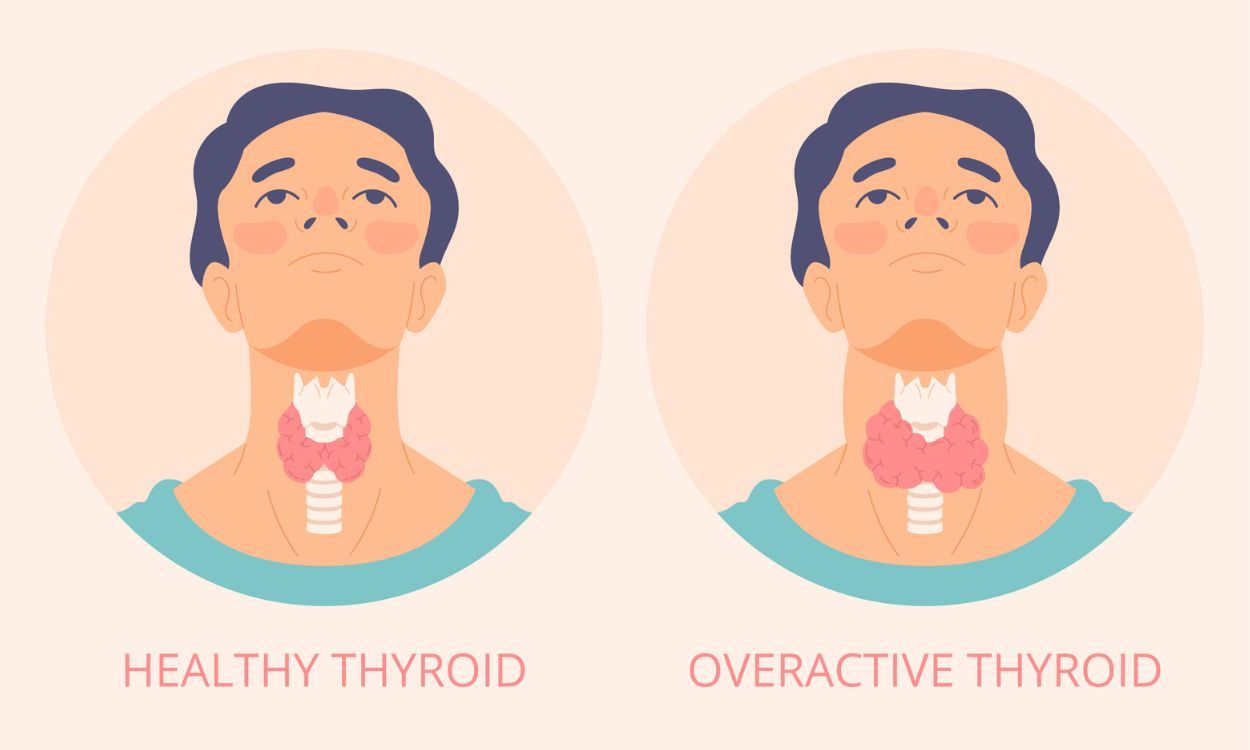 Thyroid Explained: What You Need to Know