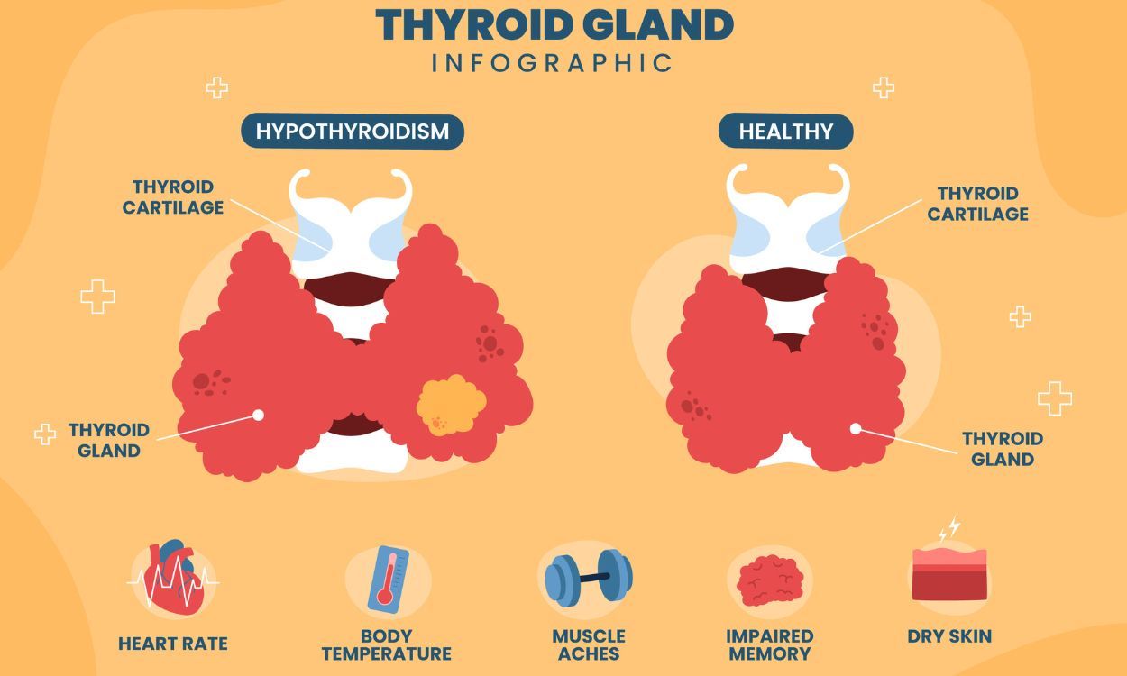 Thyroid Control