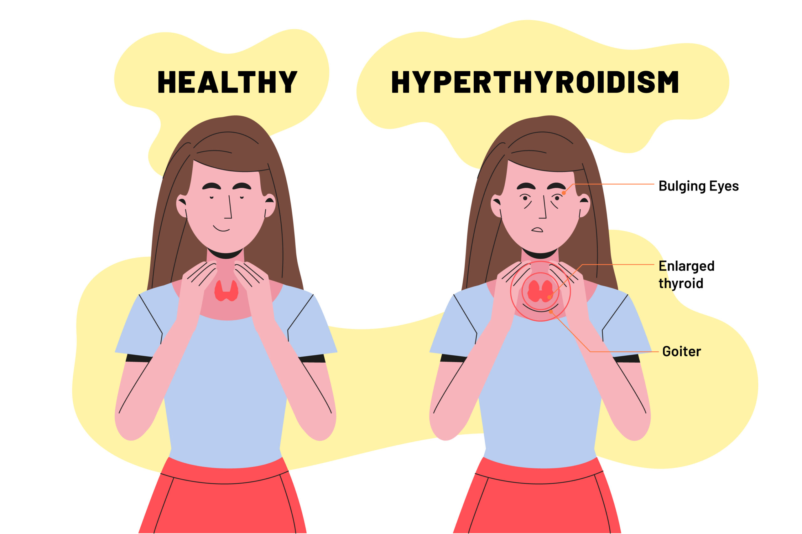 Stress & Thyroid: What's the Connection?