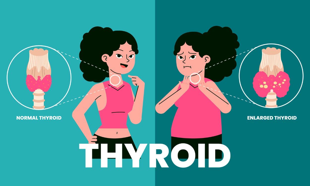 Control thyroid with simple lifestyle changes?