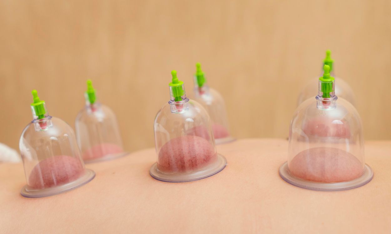 Acupuncture for Thyroid Control: A Surprising Solution?