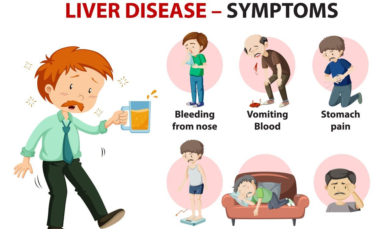 Understanding Graves' Disease: Symptoms and Treatment