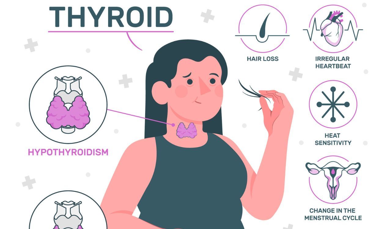 Subclinical Hypothyroidism: Causes, Symptoms, and Treatment Explained!
