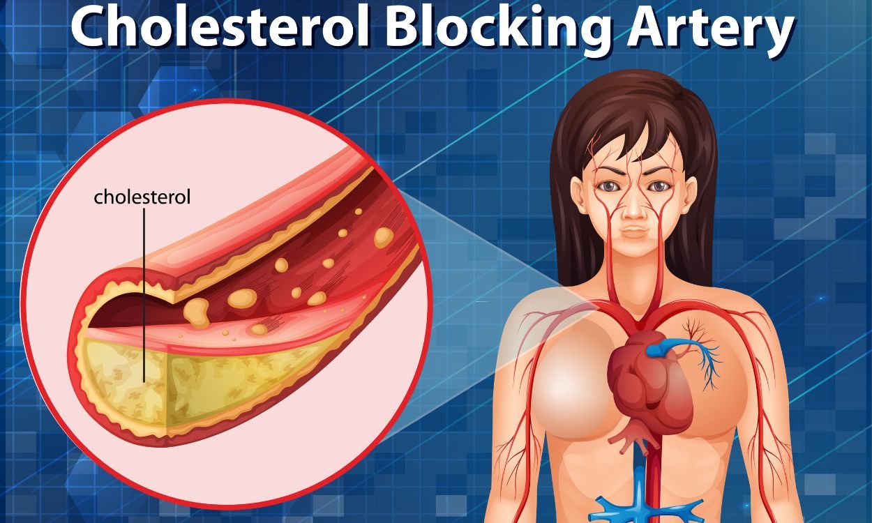 Thyroid problems and high cholesterol: Explained