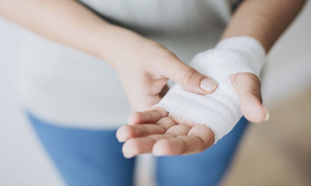 First Aid for Chemical Burns Immediate Actions and Safety Precautions