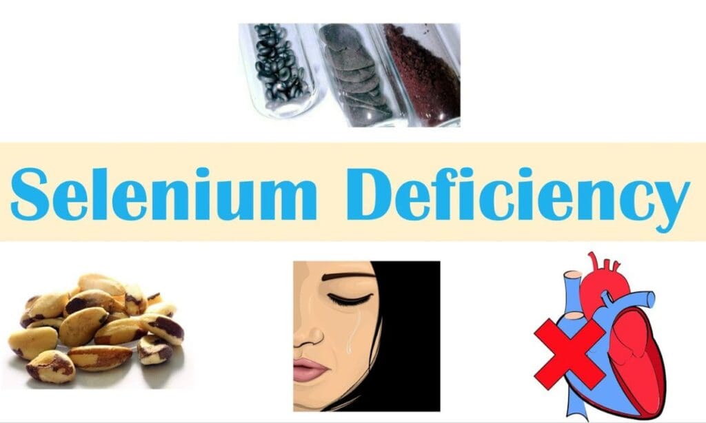 What are the symptoms of selenium deficiency? FITPAA