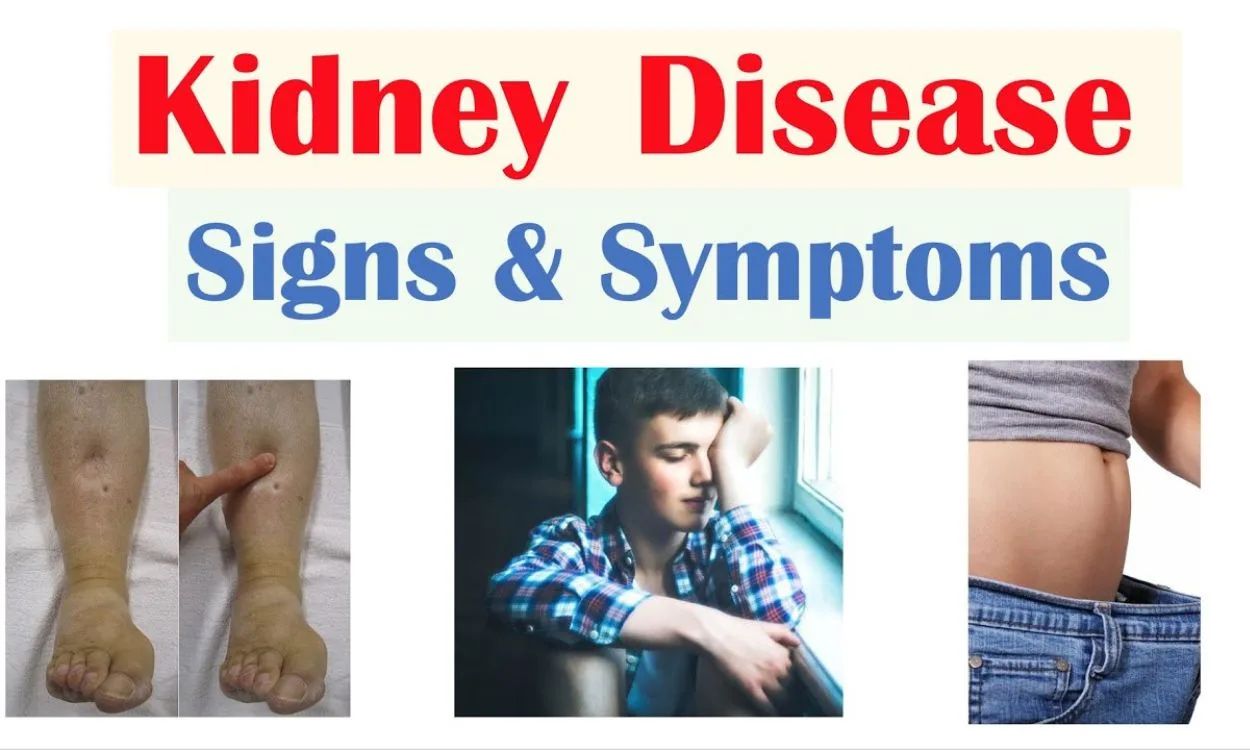 kidney failure symptoms