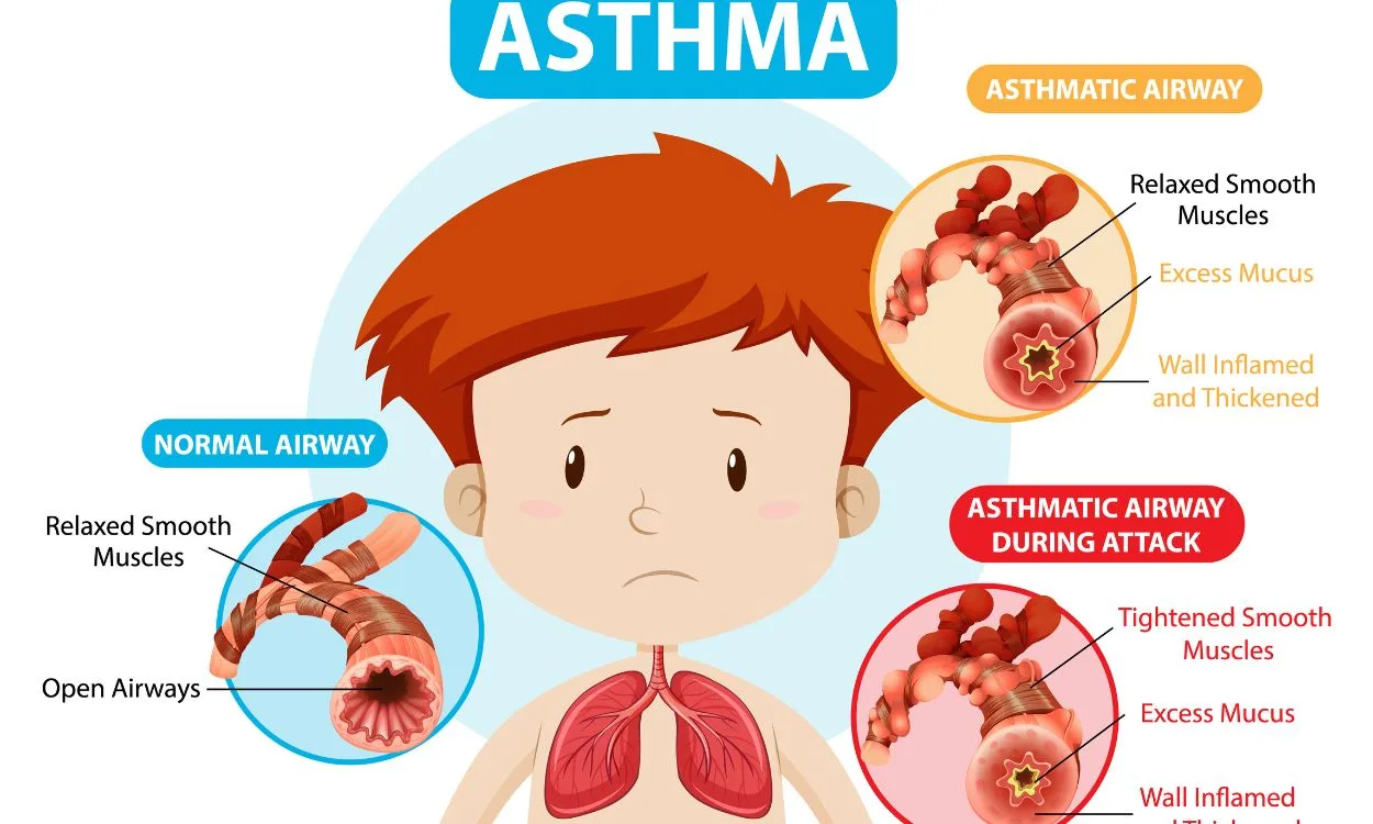 asthma attack triggers