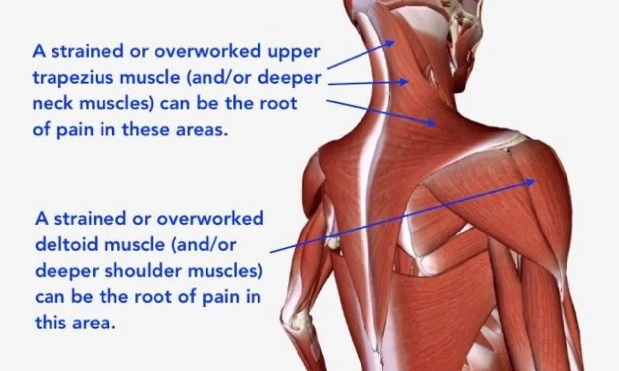 How does muscle tension in the neck affect the shoulders? - FITPAA