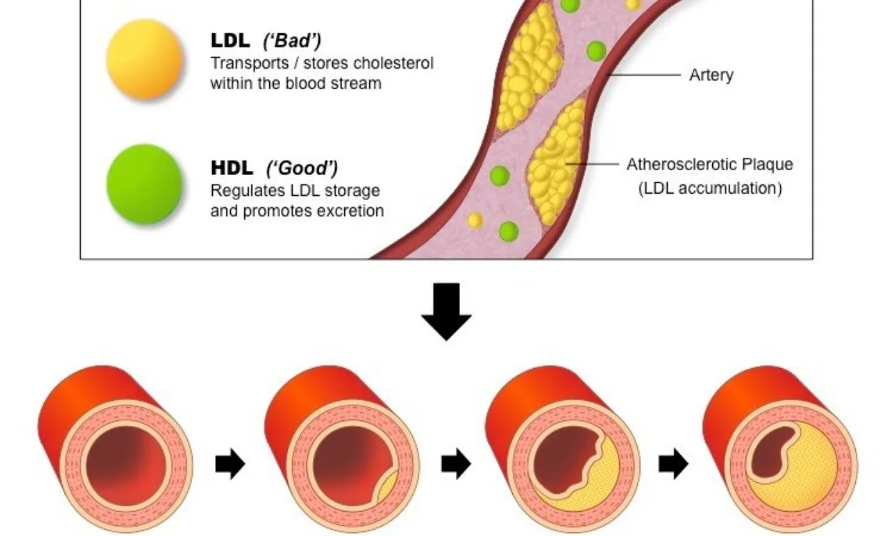 Fat intake and cholesterol