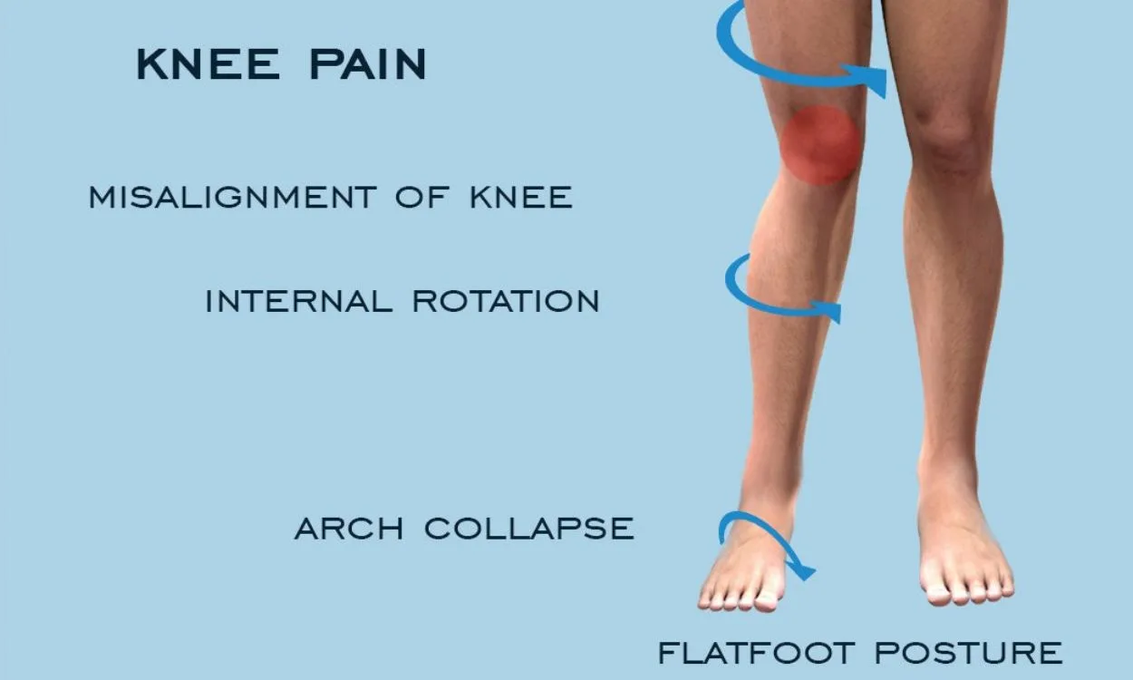 Arthritis of the Foot and Ankle - OrthoInfo - AAOS